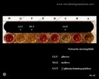 Neisseria meningitidis biochemical identification